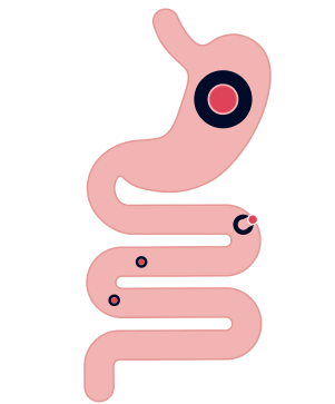 ACCRUFeR's MALTOL SHIELD (TM) traveling through the stomach and intestines